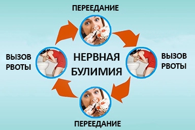 Лечение булимии в Усть-Чарышской Пристани